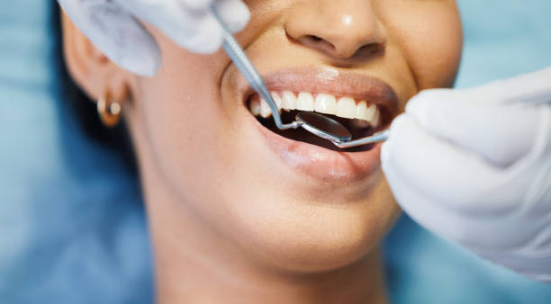 Best Emergency Treatment for Dental Infections or Abscesses in Laton, CA