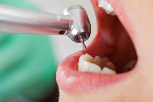 Best Emergency TMJ Treatment in Laton, CA